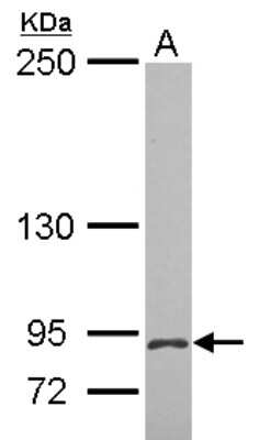Western Blot: MCTP2 Antibody [NBP2-15020]