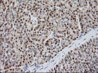 Immunohistochemistry: MCTS1 Antibody (OTI 2G2) [NBP2-45776]