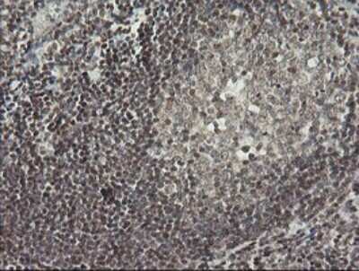 Immunohistochemistry: MCTS1 Antibody (OTI 2G2) [NBP2-45776]