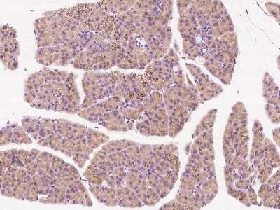 Immunohistochemistry-Paraffin: MCTS1 Antibody [NBP2-99158]