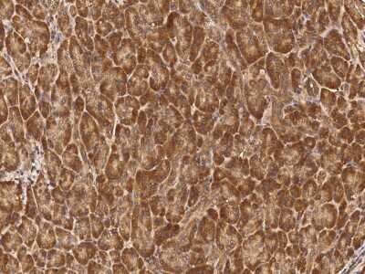 Immunohistochemistry-Paraffin: MCTS1 Antibody [NBP2-99158]