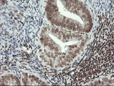 Immunohistochemistry: MCTS1 Antibody (OTI2F9) - Azide and BSA Free [NBP2-72603]
