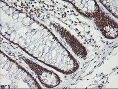 Immunohistochemistry: MCTS1 Antibody (OTI2F9) - Azide and BSA Free [NBP2-72603]