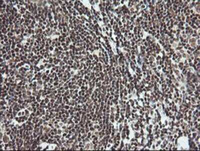 Immunohistochemistry: MCTS1 Antibody (OTI2F9) - Azide and BSA Free [NBP2-72603]