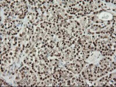 Immunohistochemistry: MCTS1 Antibody (OTI2F9) - Azide and BSA Free [NBP2-72603]