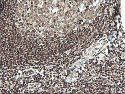 Immunohistochemistry: MCTS1 Antibody (OTI2F9) - Azide and BSA Free [NBP2-72603]