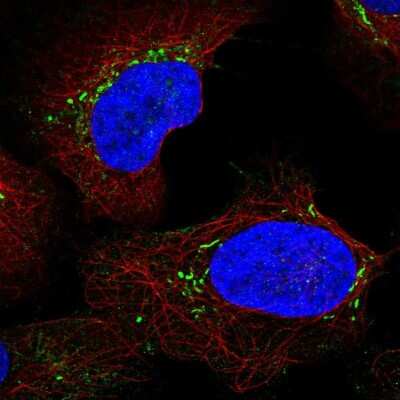 Immunocytochemistry/ Immunofluorescence: MD-2 Antibody [NBP2-55669]