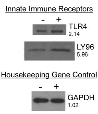 Western Blot: MD-2 Antibody [NB100-56655]