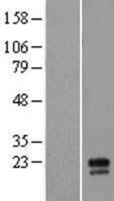 Western Blot: MD-2 Overexpression Lysate [NBL1-12751]