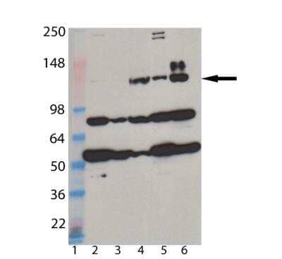 Western Blot: MDA5 Antibody (1B6) [NBP1-97526]