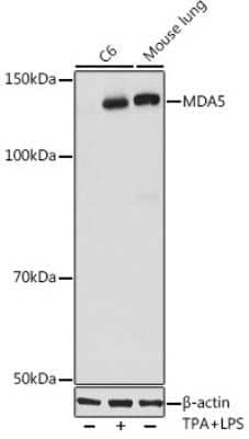 Western Blot: MDA5 Antibody (2N8Z5) [NBP3-16132]