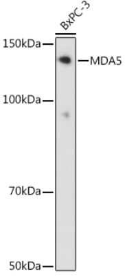 Western Blot: MDA5 Antibody (2N8Z5) [NBP3-16132]