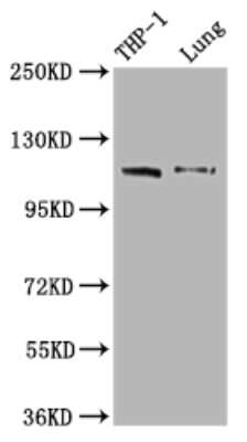 Western Blot: MDA5 Antibody (3D12) [NBP3-15166]