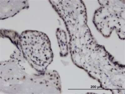 Immunohistochemistry-Paraffin: MDA5 Antibody (3F6) [H00064135-M02]