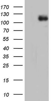 Western Blot: MDA5 Antibody (OTI8C10) [NBP2-46022]