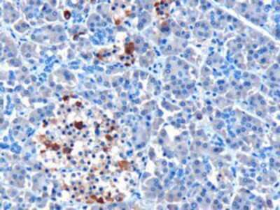 Immunohistochemistry-Paraffin: MDA5 Antibody [NB110-1244]