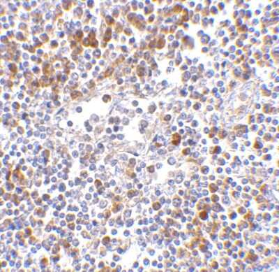 Immunohistochemistry-Paraffin: MDA5 Antibody - BSA Free [NBP1-76760]