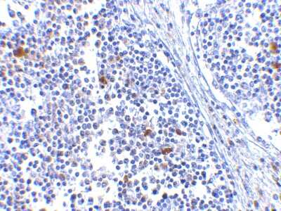 Immunohistochemistry-Paraffin: MDA5 Antibody - BSA Free [NBP1-76761]