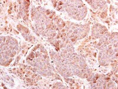 Immunohistochemistry-Paraffin: MDA5 Antibody [NBP2-17243]