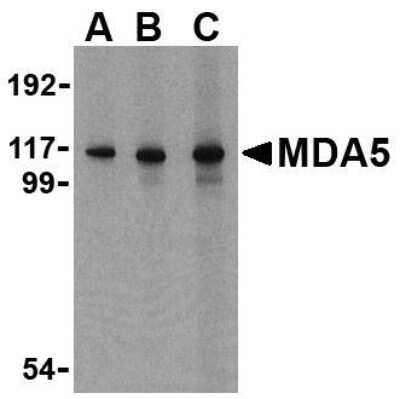 Western Blot: MDA5 AntibodyBSA Free [NBP1-76760]