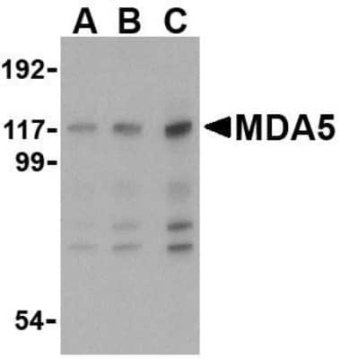 Western Blot: MDA5 AntibodyBSA Free [NBP1-76761]