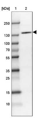 Western Blot: MDA5 Antibody [NBP1-89685]