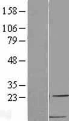 Western Blot: CCL22/MDC Overexpression Lysate [NBL1-08852]