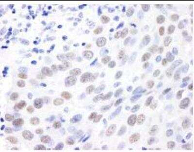 Immunohistochemistry-Paraffin: MDC1 Antibody [NB100-397]