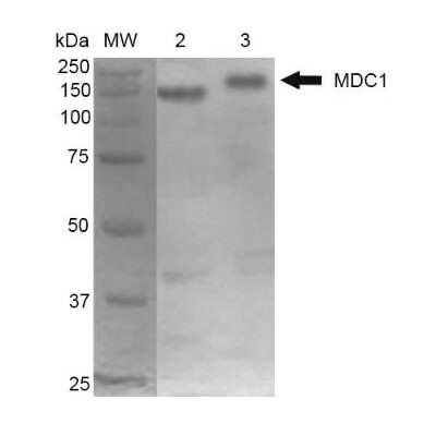 Western Blot: MDC1 Antibody (P2B11) [NBP2-12890]