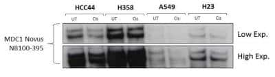 Western Blot: MDC1 Antibody [NB100-395]