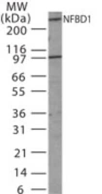 Western Blot: MDC1 Antibody [NB100-56657]