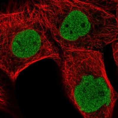 Immunocytochemistry/ Immunofluorescence: MDFI Antibody [NBP2-14225]