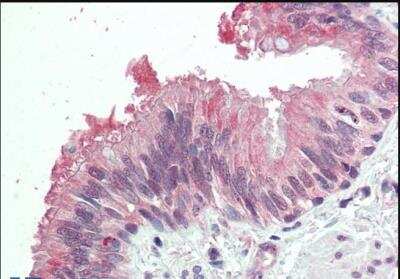 Immunohistochemistry-Paraffin: MDFI Antibody [NBP1-45224]