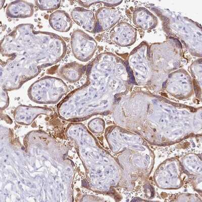 Immunohistochemistry-Paraffin: MDFI Antibody [NBP2-14225]