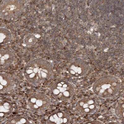 Immunohistochemistry-Paraffin: MDFIC Antibody [NBP1-93698]