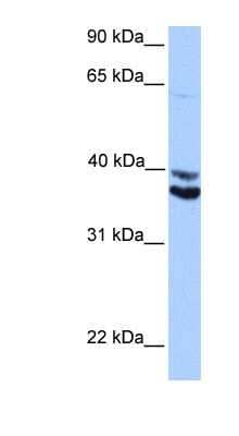 Western Blot: MDFIC Antibody [NBP1-91378]