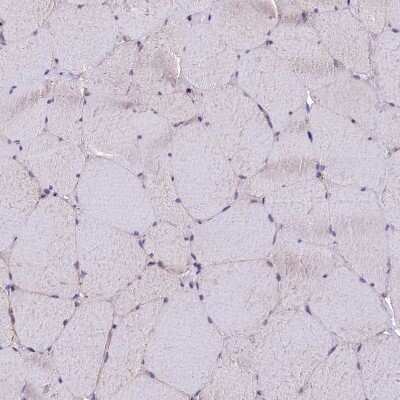 Immunohistochemistry-Paraffin: MDG1 Antibody [NBP1-87731]