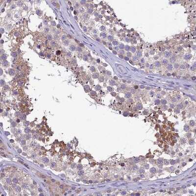 Immunohistochemistry-Paraffin: MDG1 Antibody [NBP1-87731]