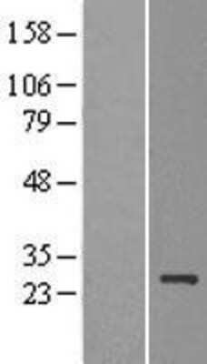 Western Blot: MDG1 Overexpression Lysate [NBL1-09943]