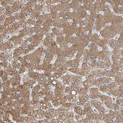 Immunohistochemistry: MDGA1 Antibody [NBP1-93712]