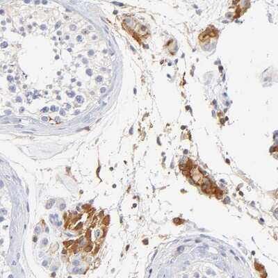 Immunohistochemistry-Paraffin: MDGA2 Antibody [NBP1-93532]