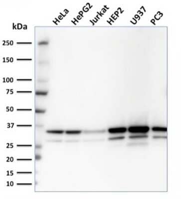 Western Blot: MDH1 Antibody (CPTC-MDH1-1) [NBP3-07289]