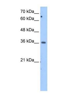 Western Blot: MDH1 Antibody [NBP1-54797]