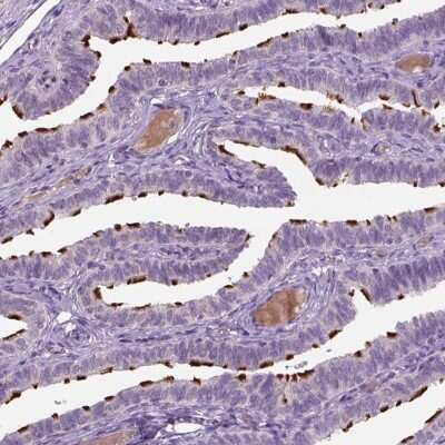 Immunohistochemistry: MDH1B Antibody [NBP2-68969]