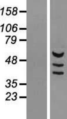 Western Blot: MDH1B Overexpression Lysate [NBL1-12965]