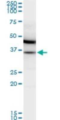 Western Blot: MDH2 Antibody (1G12) [H00004191-M01]