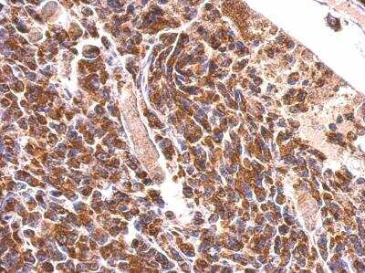 Immunohistochemistry-Paraffin: MDH2 Antibody [NBP1-32259]