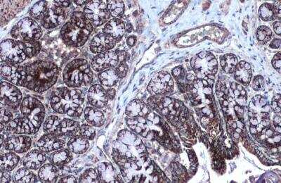 Immunohistochemistry-Paraffin: MDH2 Antibody [NBP1-32259]