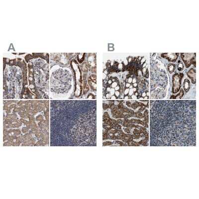 Immunohistochemistry-Paraffin: MDH2 Antibody [NBP1-89518]