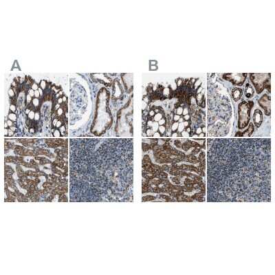 Immunohistochemistry-Paraffin: MDH2 Antibody [NBP1-89540]